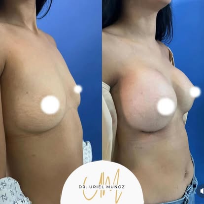 Clinic Results Gallery